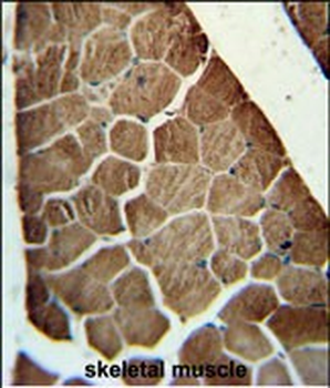 ADSSL1 Antibody (N-term)