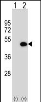 ILKAP Antibody (Center)