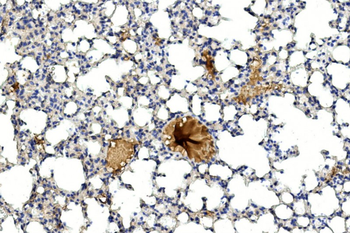 GREMLIN Antibody (C-term)