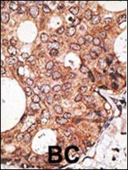 MAGEA10 Antibody (C-term)