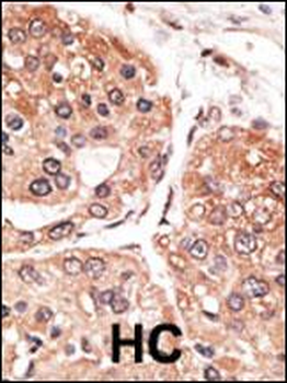 SMYD5 (RAI15) Antibody (C-term)