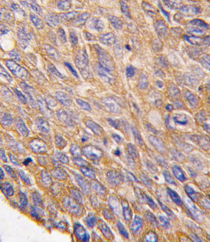 TOB2 Antibody (N-term)