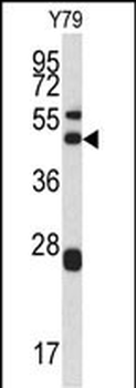 ARPC1A Antibody (Center)