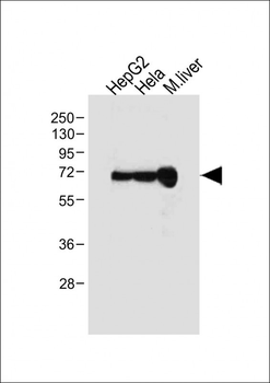 ALB Antibody (C-term)