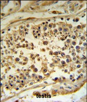 HFE Antibody (Center)