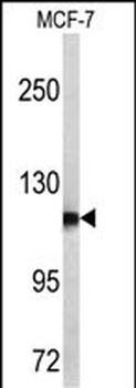 PSA Antibody (C-term)