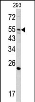 GNS Antibody (Center N189)
