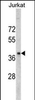 RRM2 Antibody (Center)