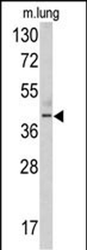 TDG Antibody (N-term)