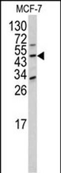 DOM3Z Antibody (N-term Y88)