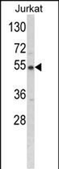BCKDHA Antibody (C-term)
