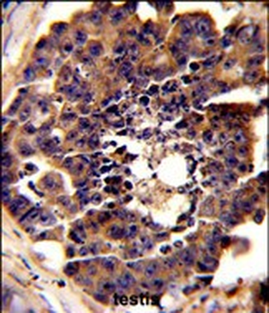 PDRG Antibody (N-term)