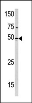 PXK Antibody (Center)