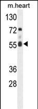 FASTK Antibody (C-term)
