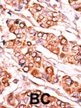 PDXK Antibody (C-term)