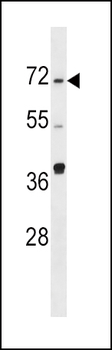 SPHK2 Antibody (N-term)