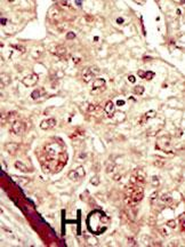 STK16 Antibody (C-term)