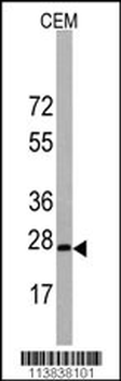 BarX1 Antibody (C-term)
