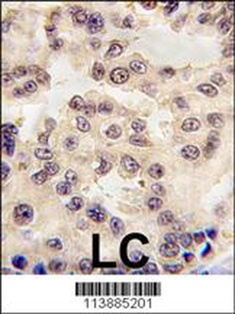 EN1 (Engrailed 1) Antibody (N-term)