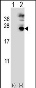 MFAP5 Antibody (C-term)