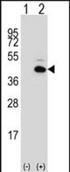 PITX1 Antibody (Center)