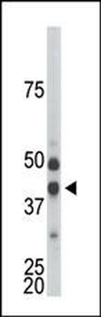 CDKL1 Antibody (C-term)