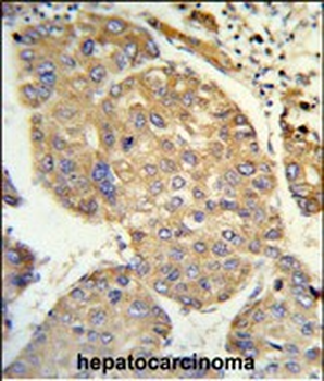 PHACTR2 Antibody (N-term)