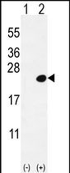DOK5 Antibody (C-term)