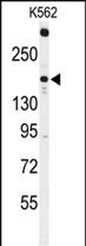ACK1 Antibody (N-term)