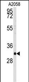 WBP2 Antibody (C-term)