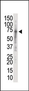 IRAK2 Antibody (C-term)