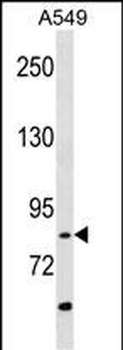 RIPK4 (ANKRD3) Antibody (C-term)