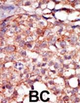 RIPK4 (ANKRD3) Antibody (C-term)