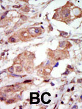 MLK2 Antibody (C-term)