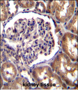TLL2 Antibody (N-term)