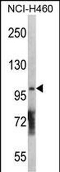 DGKQ Antibody (C-term)