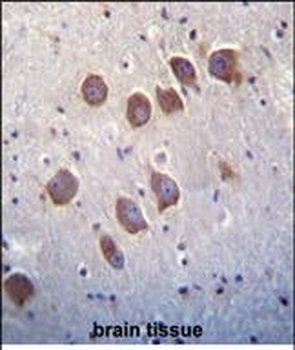 DGKQ Antibody (C-term)