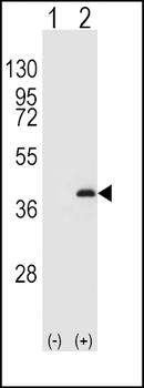 Protein Phosphatase 1 beta (PPP1CB) Antibody (C-term)