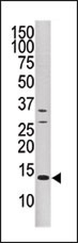 DUSP15 Antibody (N-term)