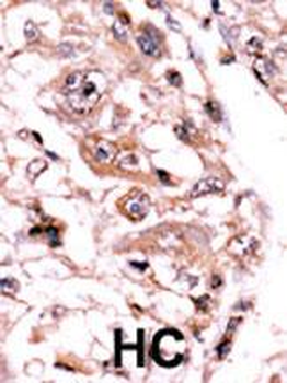 PPP3CC Antibody (C-term)
