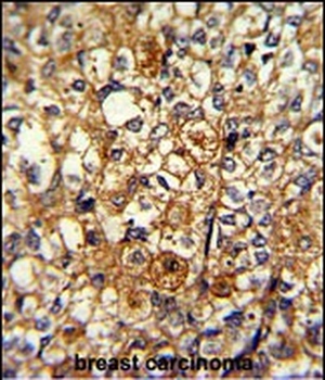 ACTN1 Antibody (N-term)