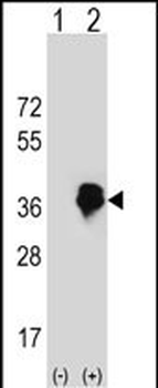 MLX Antibody (Center)