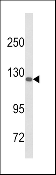 DSC1 Antibody (C-term)