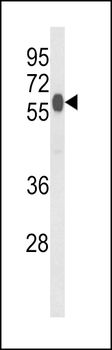 PHYH2 Antibody (C-term)