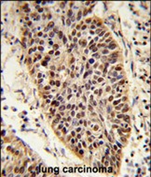 XPA Antibody (C-term)