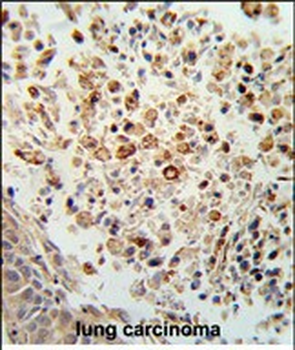 FPRL2 Antibody (Center)