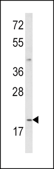 IL12A Antibody (C-term)