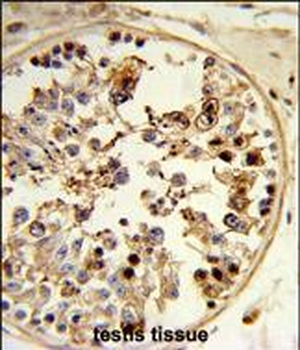 ASPSCR1 Antibody (C-term)