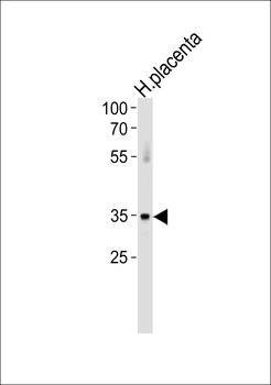 ATF7 Antibody (N-term)