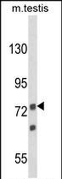 ANGEL1 Antibody (C-term)